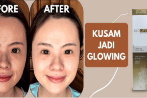 GloLift Obat Apa, Testimoni, Harga? Asli dan Palsu 2026
