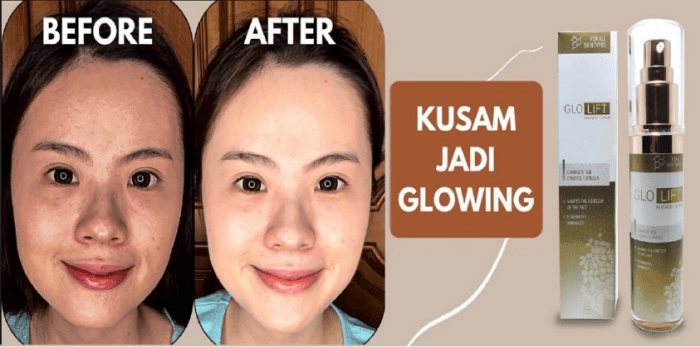 GloLift Ulasan & Testimoni di Forum GloLift serum Indonesia - Harga Ulasan Bahan
